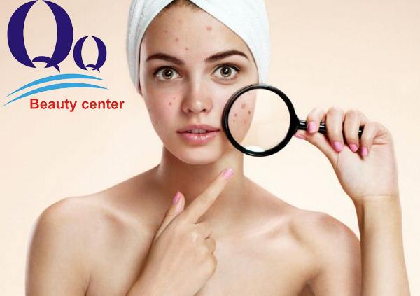 Các cách điều trị mụn mủ hiệu quả